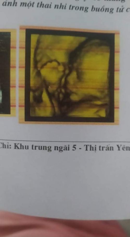 Ảnh